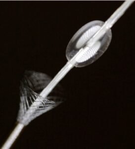 Breaking Barriers & Clots Alike: The Revolutionary Non-Surgical Solutions by iCHOR 8 iCHOR Vascular